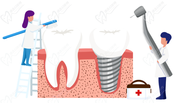 Dental implants vs ceramic crowns