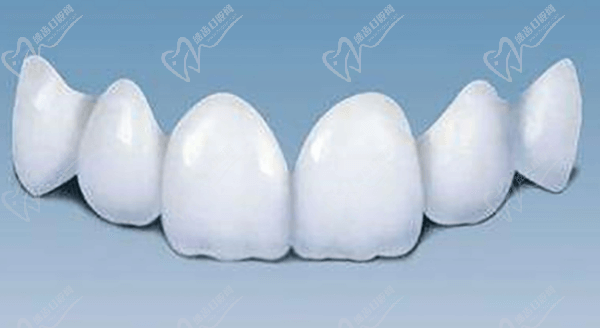 Dental implants vs ceramic crowns