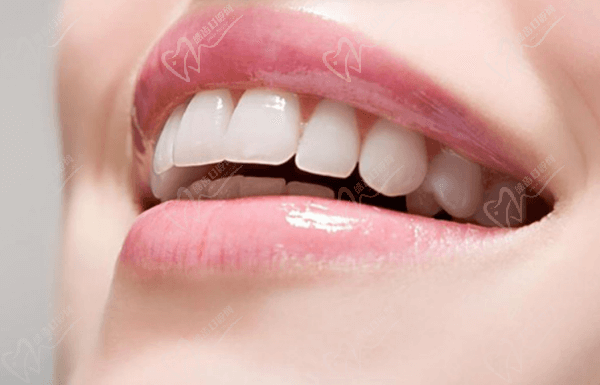 Dental implants vs ceramic crowns