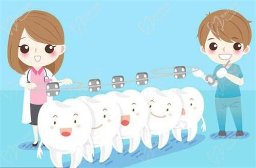 Class II malocclusion treatment