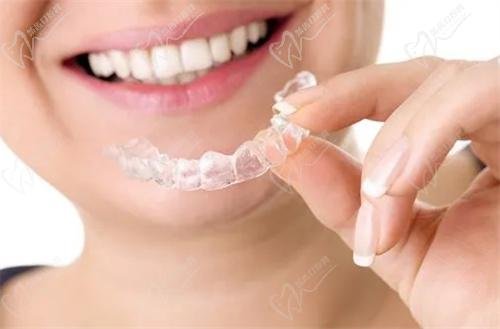 Class I malocclusion treatment